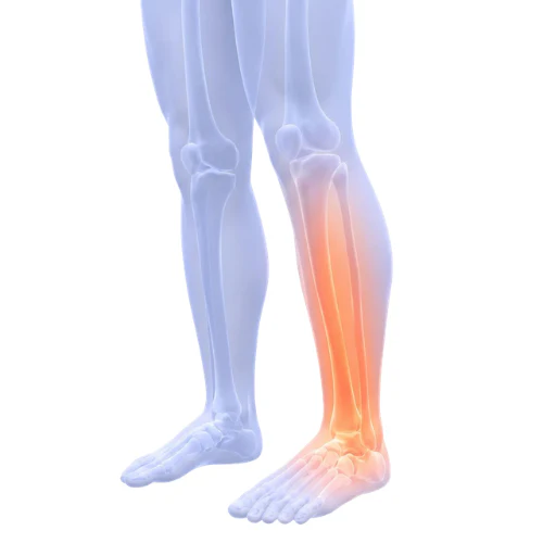 E-BOOK "Jambes légères en 7 jours